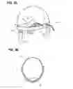Fig. 04 - Sensor and fastener