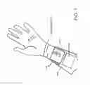 Fig. 02 - Tremor reduction system and device