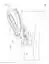 Fig. 02 - System for anchoring medical devices