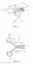 Fig. 06 - Draining device and method of draining liquid in eyelid aperture