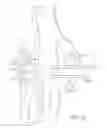 Fig. 40 - Knee balancing for revision procedures