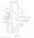 Fig. 53 - Knee balancing for revision procedures