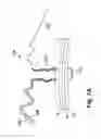 Fig. 09 - Magnetic U-stitch device