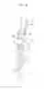 Fig. 45 - Instrument and methods for surgically closing percutaneous punctures