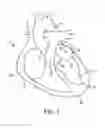 Fig. 02 - SYSTEM FOR PROVIDING SURGICAL ACCESS