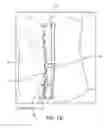 Fig. 45 - SYSTEM FOR PROVIDING SURGICAL ACCESS