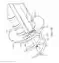 Fig. 72 - SYSTEM FOR PROVIDING SURGICAL ACCESS