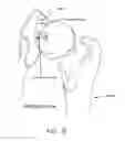 Fig. 09 - Method and apparatus for attaching tissue to bone, including the provision and use of a novel knotless suture anchor system