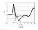 Fig. 10 - Cardiac pacing with anodal stimulation detection