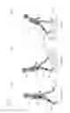 Fig. 08 - Controller unit for a functional electrical stimulation (FES) orthotic system