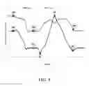 Fig. 10 - Head Worn Sensor Device and System for Exercise Tracking and Scoring