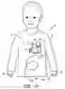 Fig. 04 - MEDICAL GARMENT