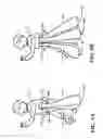 Fig. 10 - Method and Apparatus of Preventing a Fall or Minimizing the Impact of the Fall of an Individual