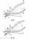 Fig. 07 - Multi-purpose archery tool