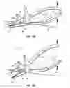 Fig. 08 - Multi-purpose archery tool