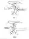 Fig. 04 - Bicycle training handle