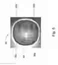 Fig. 08 - CONTAINER FOR EGGS, METHOD AND APPARATUS FOR ARRANGING AND STABILIZING EGGS IN A CONTAINER