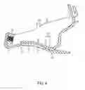Fig. 05 - Hybrid brake pedal feel system