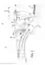 Fig. 03 - Method for improved assembly of an actuator for an air bleed valve of a turbine engine