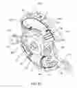 Fig. 09 - ROTARY PISTON INTERNAL COMBUSTION ENGINE