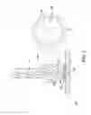 Fig. 06 - BUTTON FOR ROCKER ARM ASSEMBLY