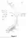 Fig. 02 - Tracheal tube and suction device