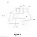 Fig. 06 - Tracheal tube and suction device