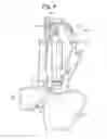Fig. 05 - INHALER COUNTER
