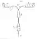 Fig. 01 - Intrauterine device with controlled copper ion elution