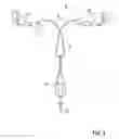 Fig. 04 - Intrauterine device with controlled copper ion elution