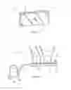 Fig. 06 - REPAIR AND PREVENTIVE MAINTENANCE SYSTEM AND METHOD FOR FIBERGLASS BOATS