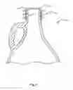 Fig. 06 - GLASS CONTAINER WITH ROLL-ON CLOSURE