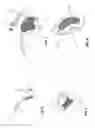 Fig. 04 - Radioactive glass source