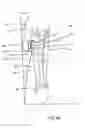Fig. 08 - LEG SUPPORT FOR VEHICLE OCCUPANT