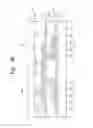 Fig. 04 - Liquid crystal display