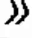 Fig. 02 - Ophthalmic lens