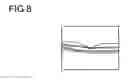 Fig. 06 - Control method of a fundus examination apparatus
