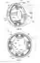 Fig. 04 - Hermetically sealed damper assembly and methods of assembling same