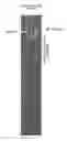 Fig. 01 - Spot welded joint
