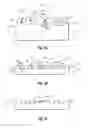 Fig. 04 - Method of manufacturing an orthodontic bracket having a laser shaped green body