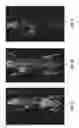 Fig. 06 - PSMA-targeting compounds and uses thereof