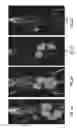 Fig. 07 - PSMA-targeting compounds and uses thereof