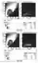 Fig. 28 - PSMA-targeting compounds and uses thereof