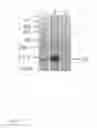 Fig. 04 - HOUSE DUST MITE ALLERGEN