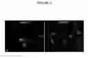 Fig. 03 - Human Antibodies and Specific Binding Sequences Thereof for use in Stroke and Ischemia or Ischemic Conditions