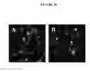 Fig. 45 - Human Antibodies and Specific Binding Sequences Thereof for use in Stroke and Ischemia or Ischemic Conditions