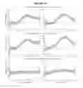 Fig. 52 - Human Antibodies and Specific Binding Sequences Thereof for use in Stroke and Ischemia or Ischemic Conditions