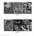 Fig. 03 - Therapeutic for treating infection