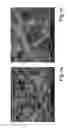 Fig. 02 - Growth-inhibited hydroxyapatite, process for its preparation and use