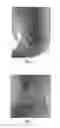 Fig. 02 - Use of pharmaceutical compositions in preparing pharmaceuticals for treating diabetic ulcer